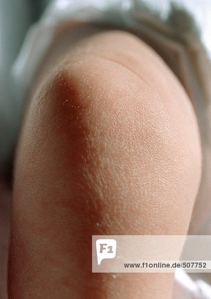 Baby's leg,  close-up