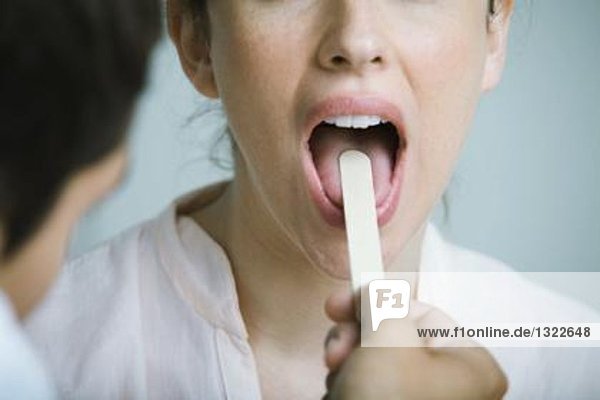 Arzt hält die Zunge der Frau mit Zungenspatel fest
