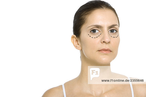 Frau mit plastischen Operationsmarkierungen unter den Augen  Blick auf die Kamera