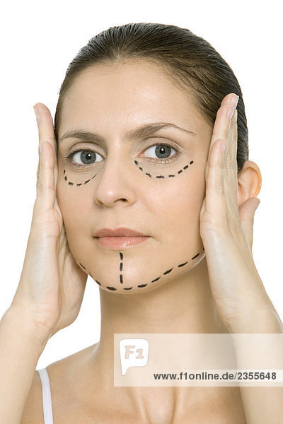 Woman with plastic surgery markings on face  holding face in hands  looking at camera