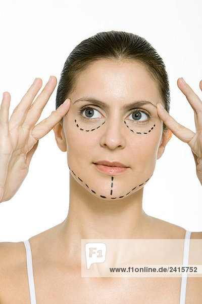 Frau mit plastischen Operationsmarkierungen im Gesicht  hält Schläfen  schaut weg