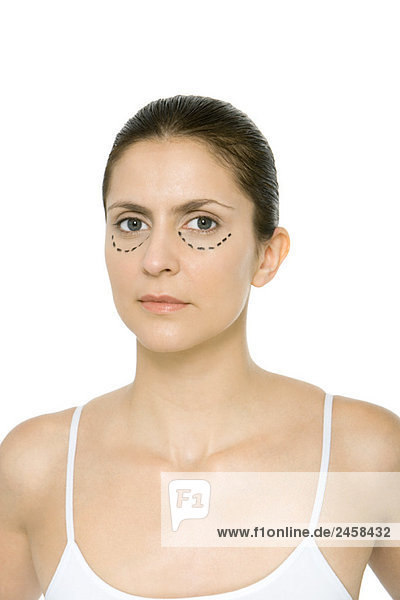 Frau mit plastischen Operationsmarkierungen unter den Augen  Portrait