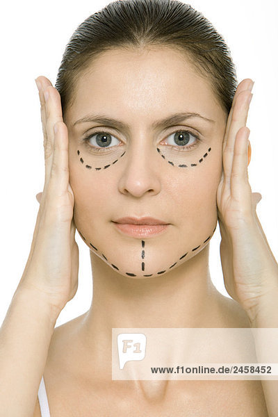 Frau mit plastischen Operationsmarkierungen im Gesicht  Gesicht in den Händen haltend  Kamera betrachtend