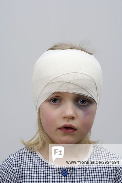 A young girl with a black eye and bandaged head