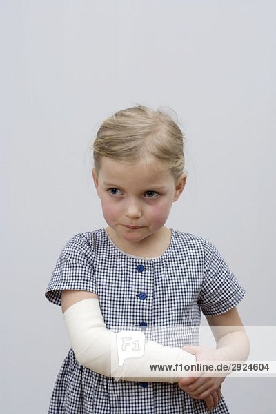 A young girl with a broken arm