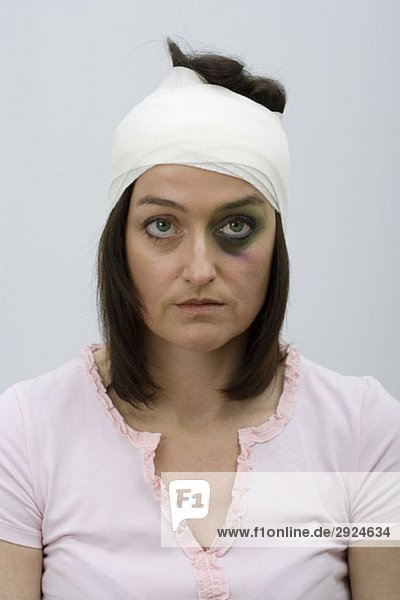 A woman with a black eye and bandaged head