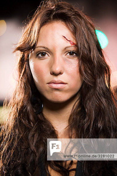 Teenage girl with facial injuries