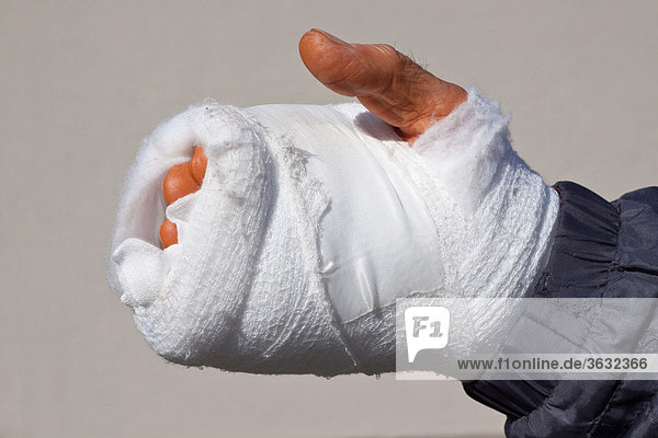 Frisch operierte verbundene Hand nach einem Arbeitsunfall  die Haut noch rötlich orange verfärbt durch Desinfektionsmittel