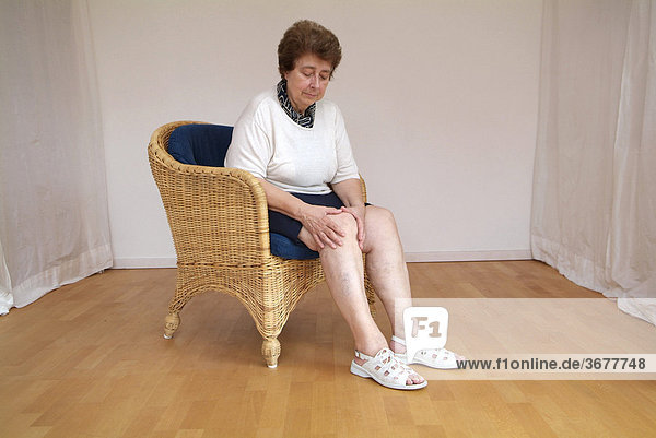 Frau mit arthrose fasst sich an das knie