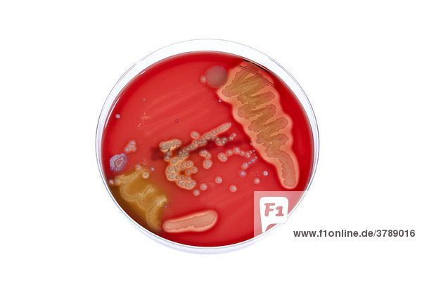 Eine in einer Petrischale wachsende Bakterienkultur