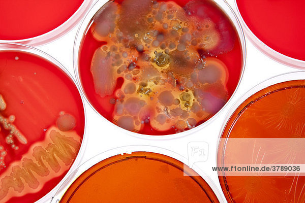 Petrischalen mit verschiedenen Stadien von Bakterienkulturen