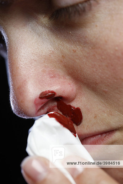 Nose of a young woman bleeding