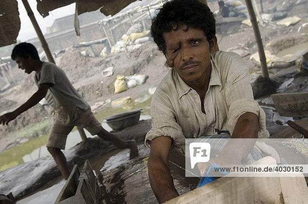 Viele Slumbewohner leben vom Recycling alter Industrieabfälle. Tagelöhner waschen hier giftige Industrieschlacke auf der Suche nach Metallresten. Kohle- und Schwefeldampf von der Metallschmelze nebenan liegen in der Luft. Dieser Arbeiter hat eine tumoröse Geschwulst auf der rechten Gesichthälfte. Unbehandelte Erkrankungen dieser Art findet man in den Slums recht häufig. Howrah  Hooghly  Westbengalen  Indien