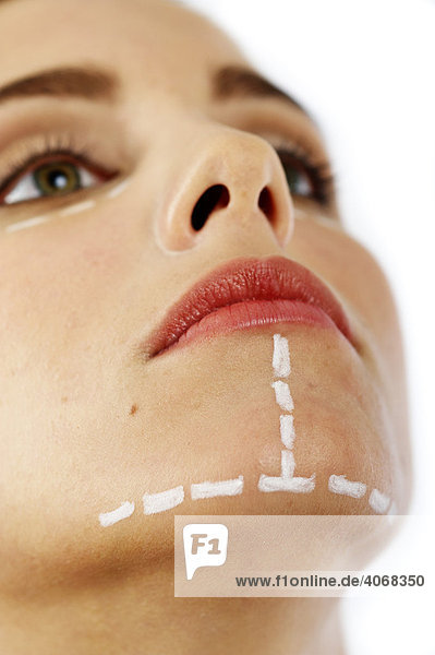 Young woman with lines on her face for cosmetic surgery
