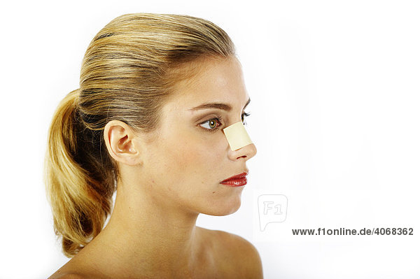 Young woman with marking for a rhinoplasty  nose job