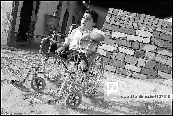 Behinderter Junge in Kirkuk