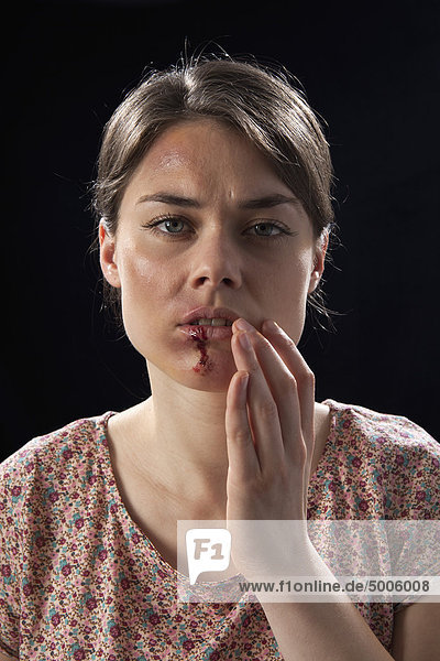 Eine Frau mit blauen Flecken und blutigen Lippen.