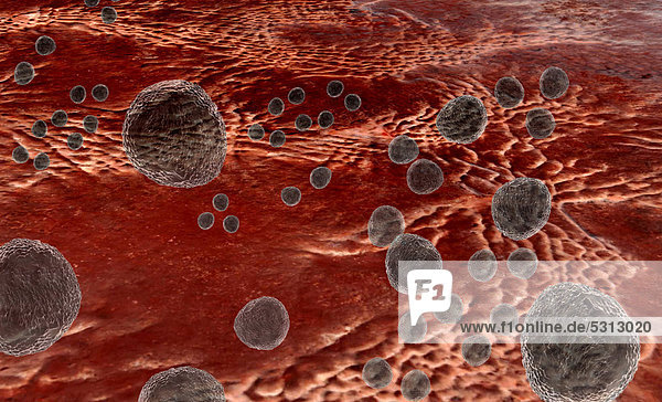 Staphylococcus  ein gefährlicher Krankheitserreger  Bakterien  Illustration