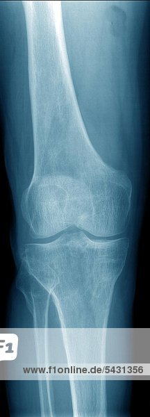 Röntgenfotos einer chirurgischen Praxis. Knie ohne Befund.