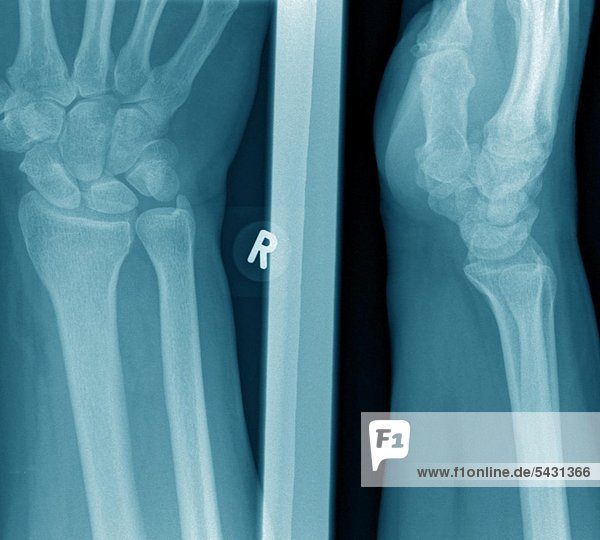 Röntgenfotos einer chirurgischen Praxis. Hand und Handgelenk ohne Befund