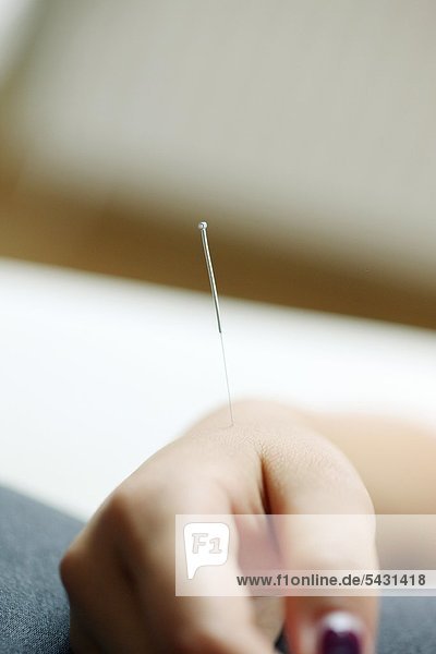 Akupunktur Behandlung einer Hand - Korean Handakupunktur