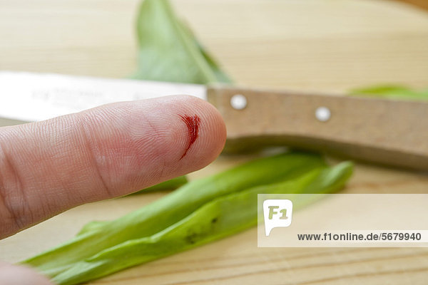 Bleeding index finger  laceration with a kitchen knife  household accident