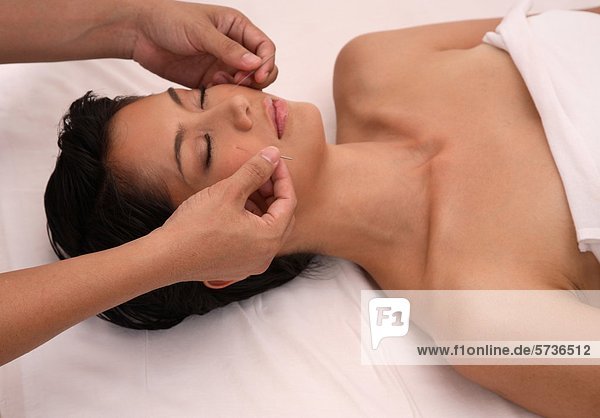 Frau  die Akupunktur-Behandlung Gesicht