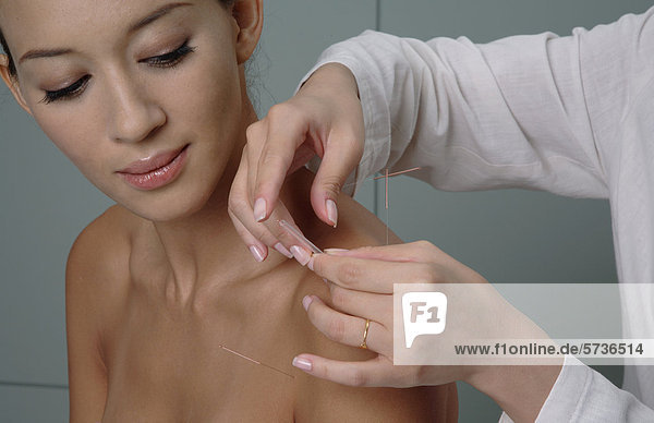 Frau mit Akupunktur-Behandlung auf Schulter
