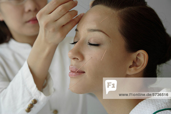 Woman having acupuncture treatment on face                                                                                                                                                          