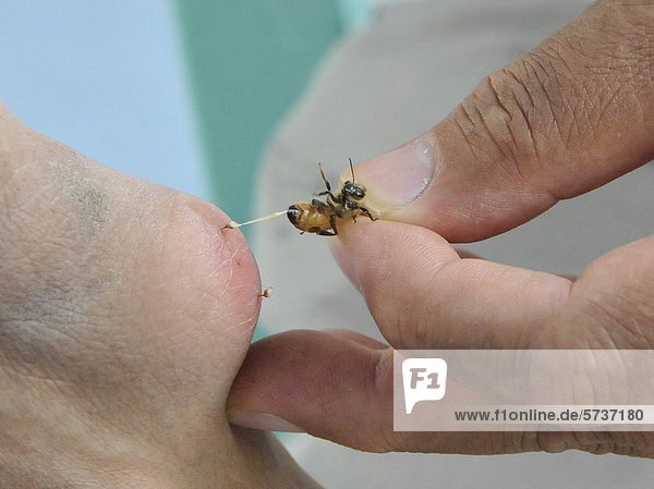 Asia  Philippines  Tagaytay  bee-sting healer                                                                                                                                                       
