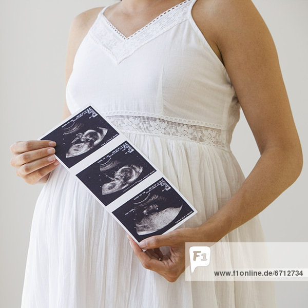 Frau  halten  Schwangerschaft  Ultraschalluntersuchung  ausdrucken  drucken