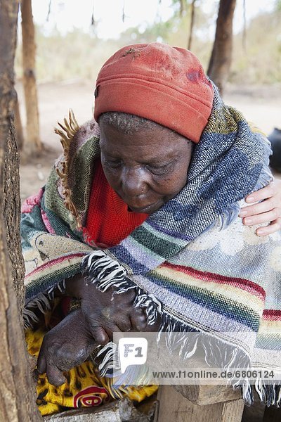 Lepra  Frau  Mensch  Afrika  Mosambik