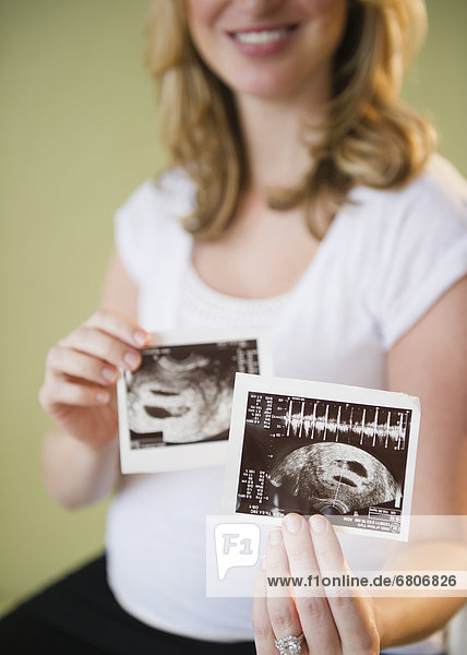 pregnant woman showing sonograms