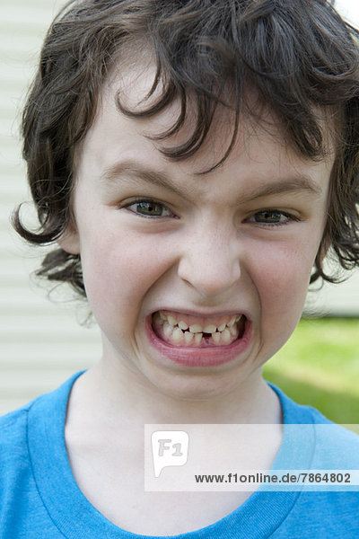 Junge grimassiert  zeigt fehlenden Zahn  Porträt