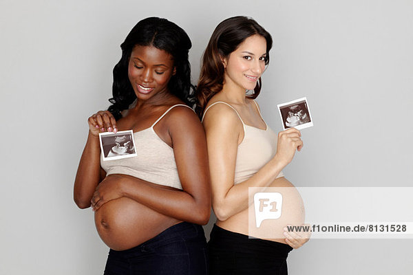 Zwei schwangere Frauen mit Ultraschalluntersuchungen