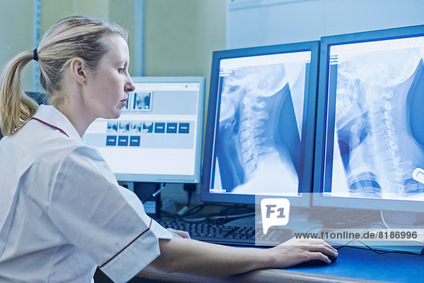 Frau beim Röntgen