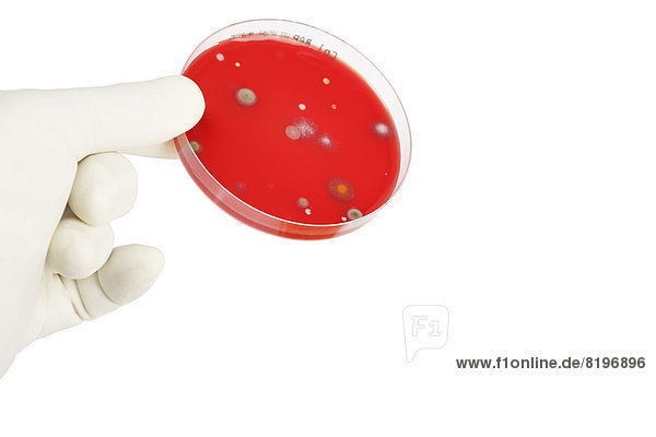 Junge Frau hält Petrischale mit Bakterien in der Hand