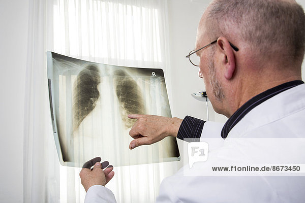 Doctor checking the x-ray image of a lung  Germany