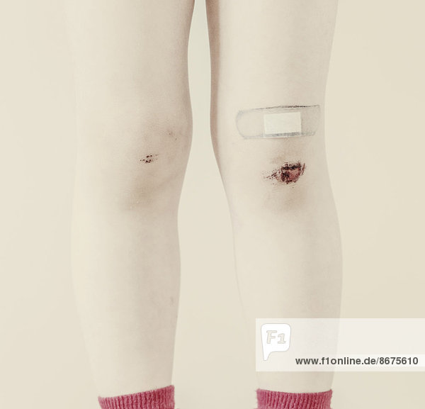Child's legs with bruises and band-aid