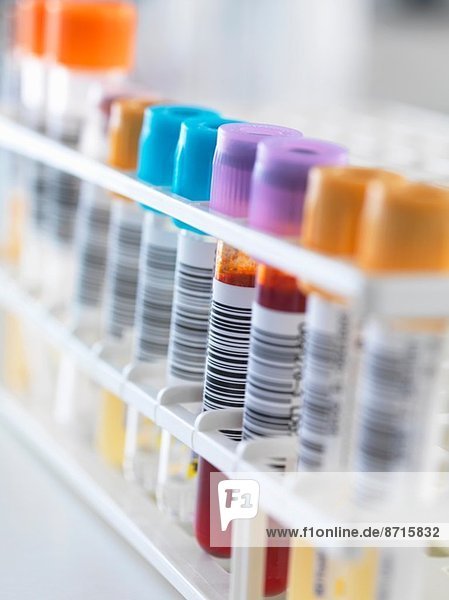 Eine Reihe von menschlichen Proben für analytische Tests  einschließlich Blut  Urin  Chemie  Proteine  Antikoagulanzien und HIV.
