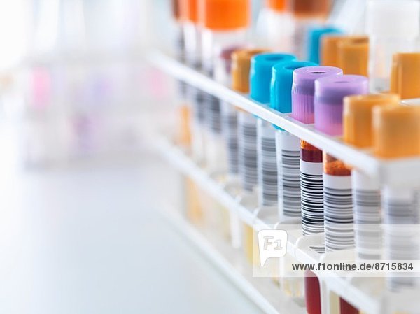 Eine Reihe von menschlichen Proben für analytische Tests  einschließlich Blut  Urin  Chemie  Proteine  Antikoagulantien und HIV im Labor.