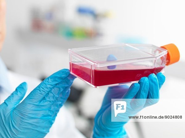 Hände eines Zellbiologen  der eine Flasche mit Stammzellen hält  die in rotem Wachstumsmedium kultiviert wird  um Krankheiten zu untersuchen