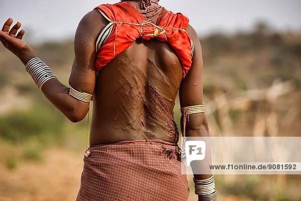 Hamer woman´s back after being whipped at a bull jumping ceremony near  Turmi in the Omo Valley, Ethiopia. The young women taunt the men into  hitting them harder, thinking that if they