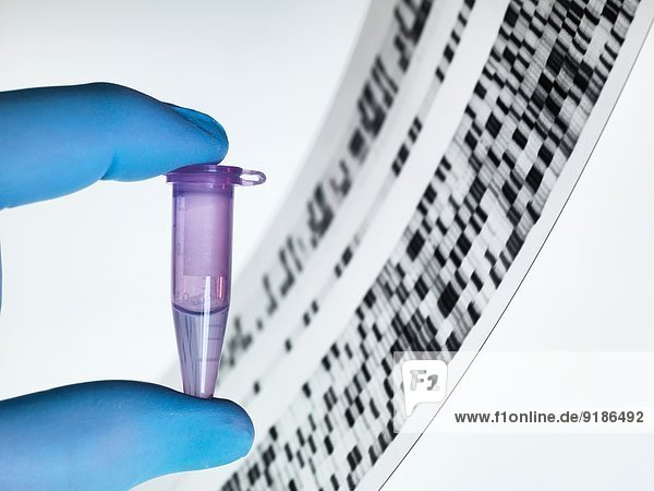 Genprobe und DNA-Autoradiogramm