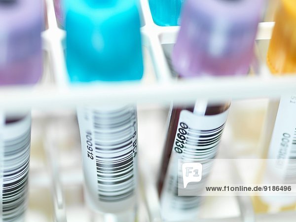 Eine Reihe von menschlichen Blut- und Chemieproben,  die im Labor getestet werden müssen.