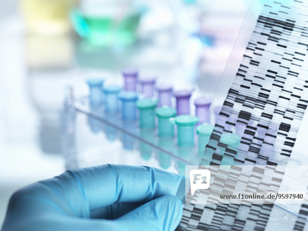 Wissenschaftler hält DNA-Gel vor Proben für Laboruntersuchungen