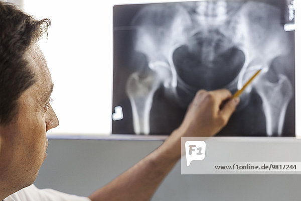 Arzt zeigt auf Röntgenbild eines Beckens