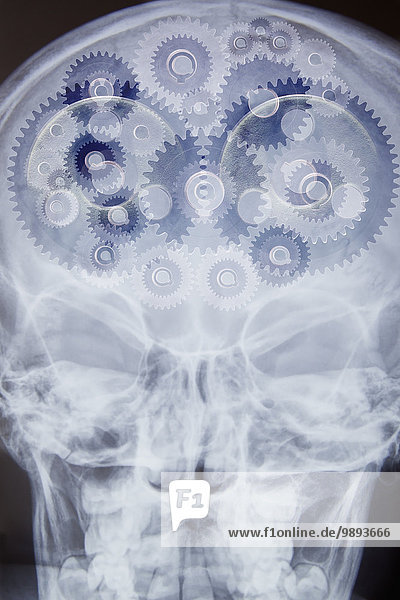 Röntgenaufnahme des Schädels mit Zahnrädern als Gehirn,  digitale Montage