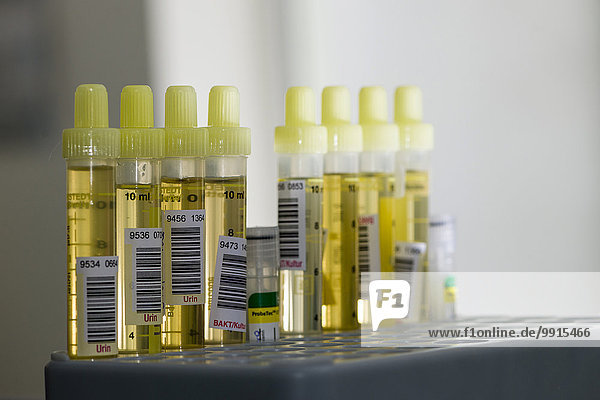Röhrchen mit gelbem Urin gefüllt  in einem grauen Gestell  sortiert  bereit für die Diagnose