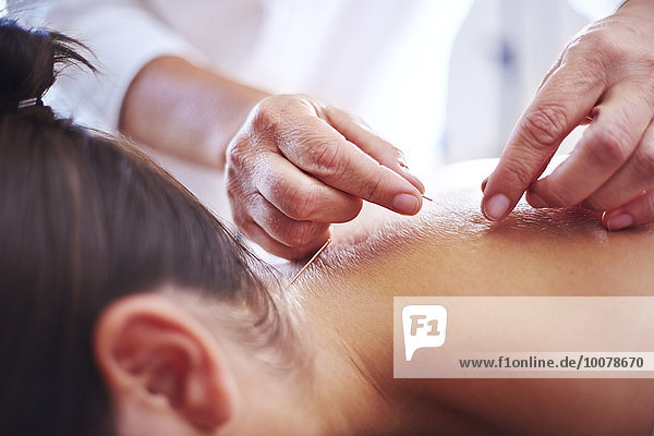 Close up acupuncturist applying acupuncture needles to woman’s neck